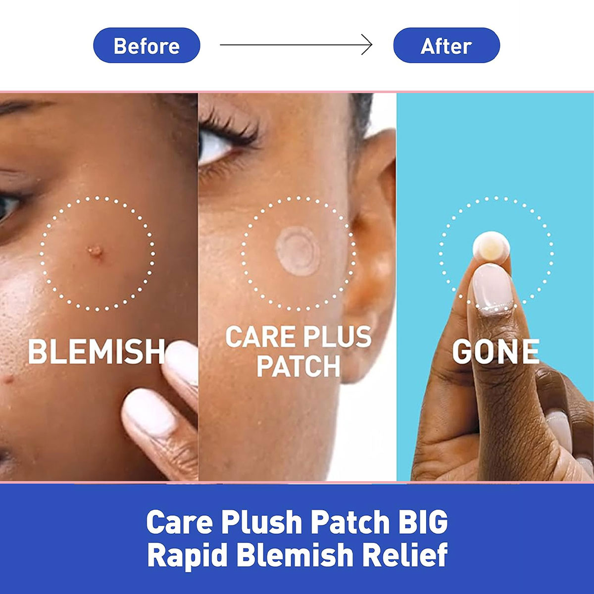 Parches para Cubrir Manchas Ol - Face Oil reseña y precio